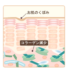 お肌を支えるコラーゲンの減少