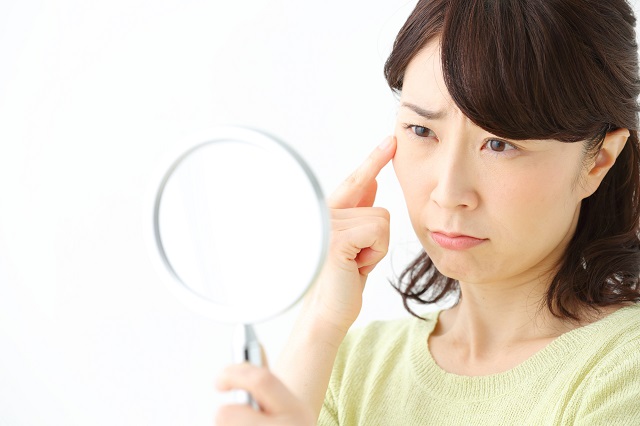 代表的なシワの種類