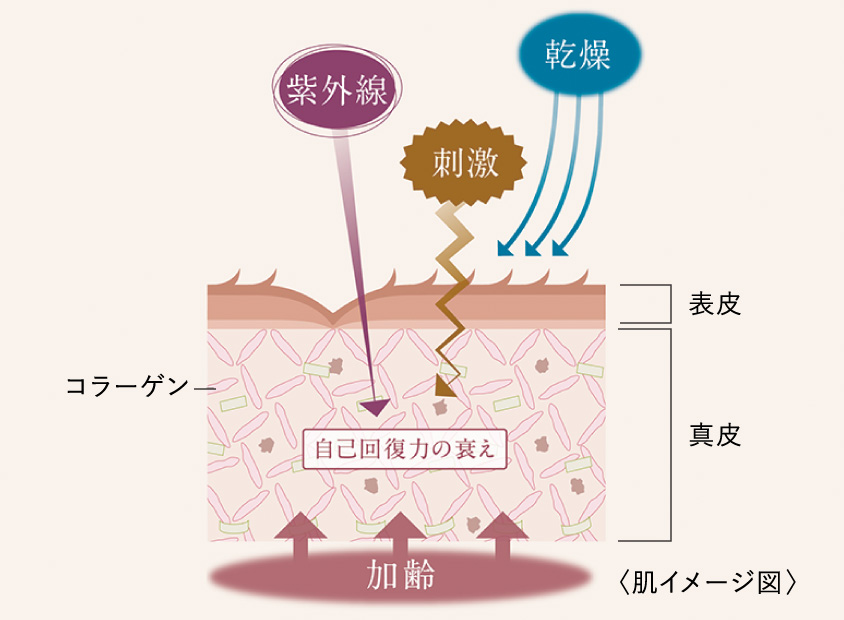 紫外線 刺激 乾燥 コラーゲン 表皮 真皮 自己回復力の衰え 加齢 肌イメージ図