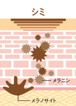 シミ メラニン メラノサイト