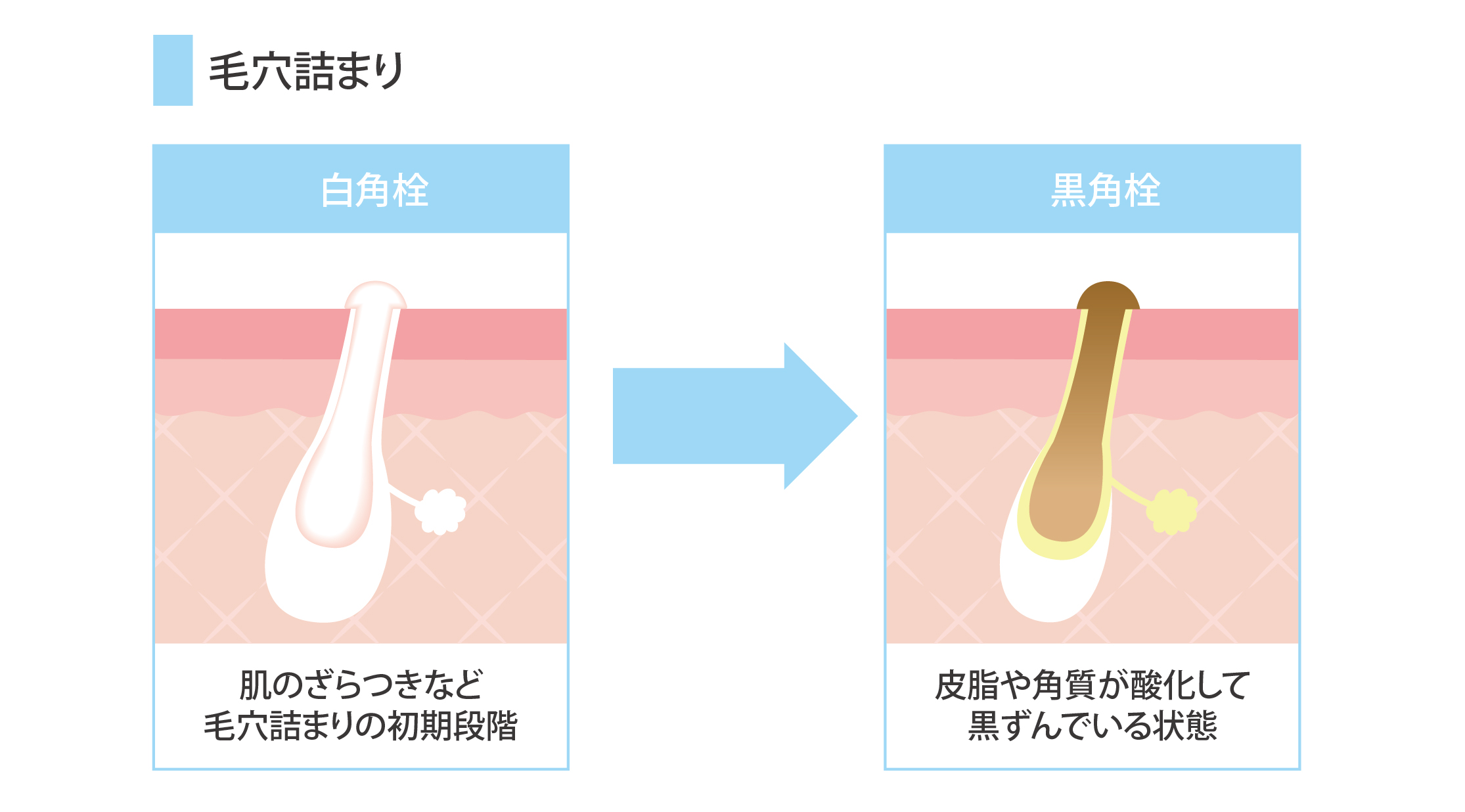 �ь��l�܂�̃��J�j�Y��