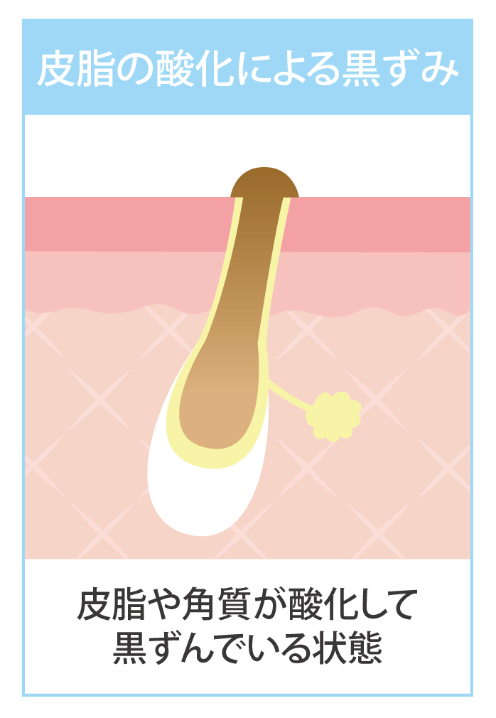玉̎_ɂ鍕݂̃CXg
