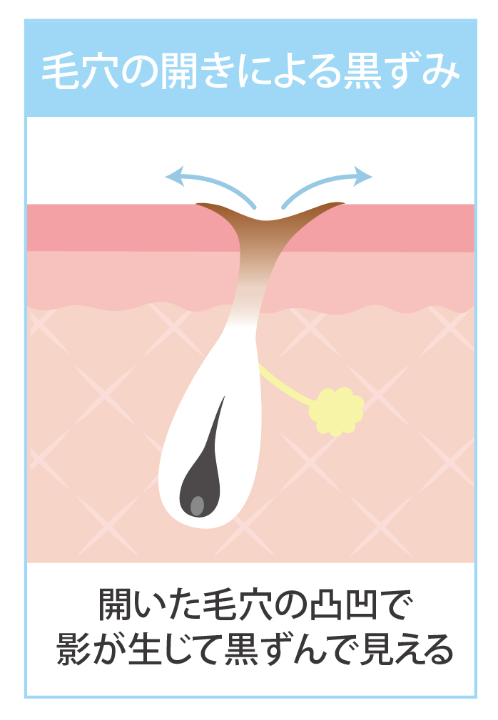 ь̊Jłłeɂ鍕݂̃CXg