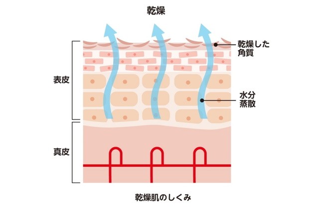 顔の乾燥 説明イラスト