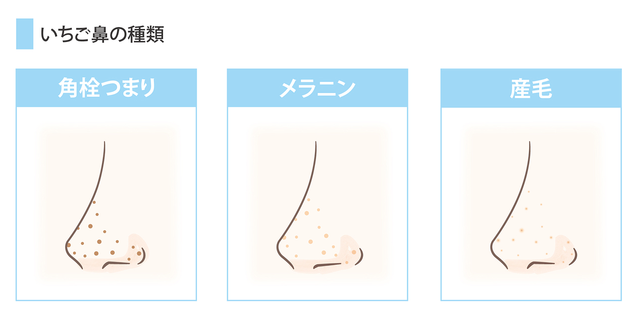 @摜Abv