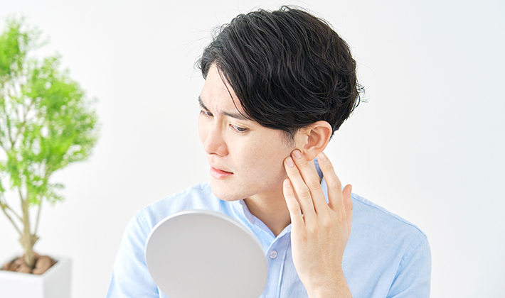 男性の肌荒れが治らない原因はコレ!対策方法を紹介
