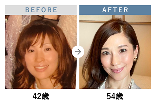 �r�t�H�[�A�t�^�[