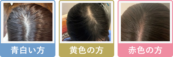 �������E���F�̕��E�ԐF�̕�