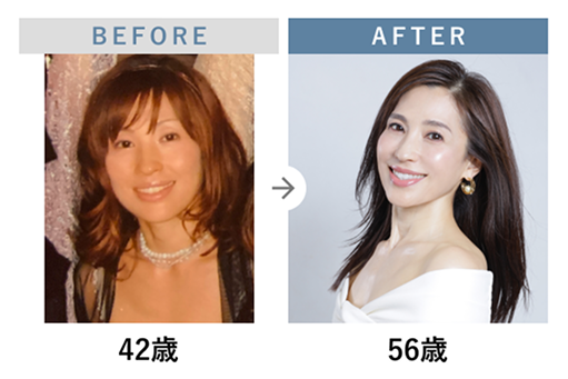 BEFORE(42��)��AFTER(56��)�̔�r�摜