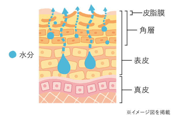 バリア機能が低下した肌 画像