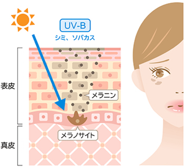 UV-B説明画像