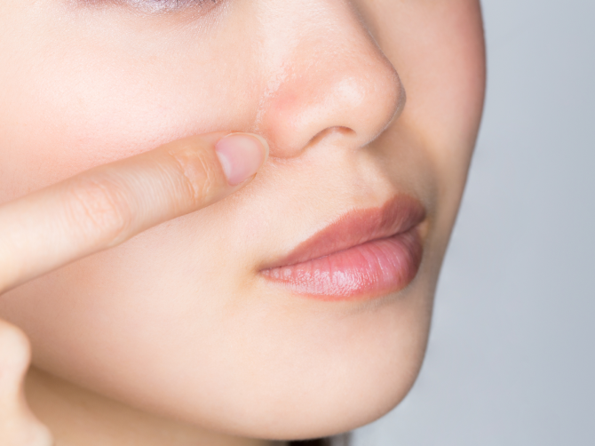 【毛穴ケア】あなたの毛穴はどのタイプ? タイプ別のおすすめケアをご紹介