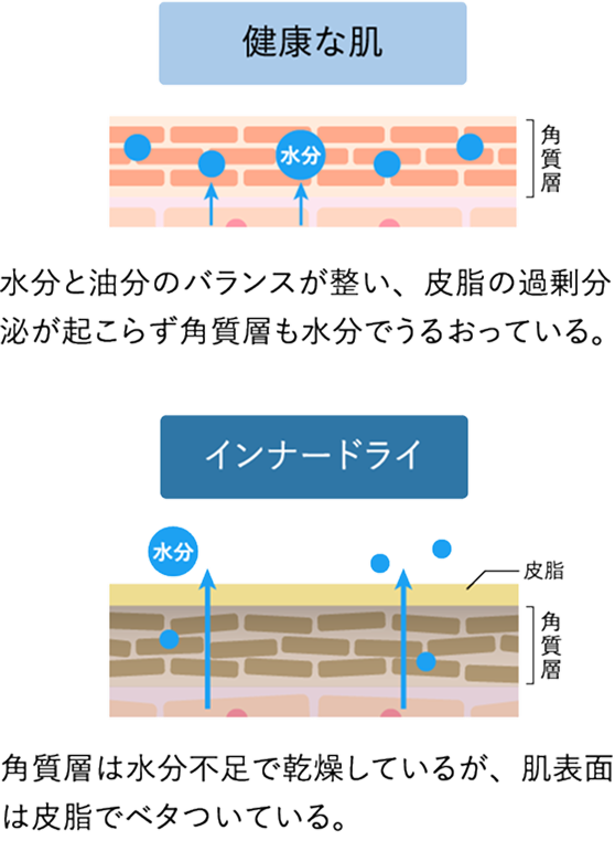 健康な肌とインナードライの比較画像