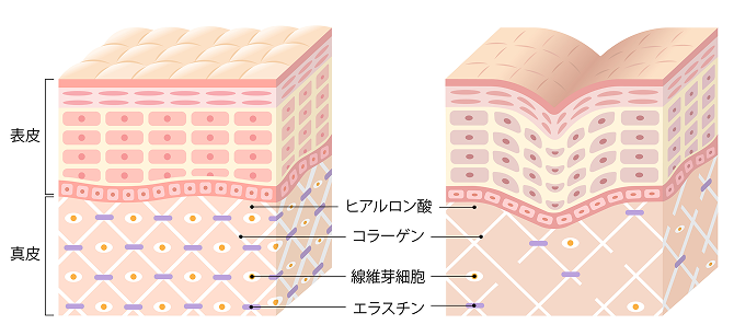 肌の断面図