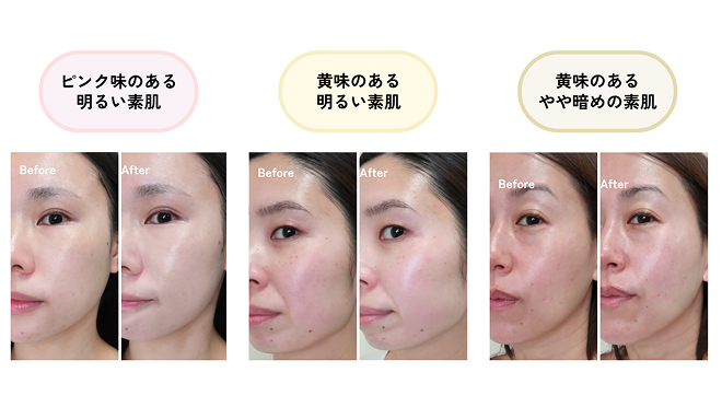 �s���N���̂��閾�邢�f���A�����̂��閾�邢�f���A�����̂�����Âߑf��