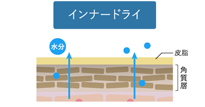 �C���i�[�h���C�̔��f�ʂ̗l�q