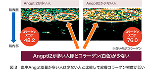 Angptl2が多い人・少ない人のコラーゲン量イメージ