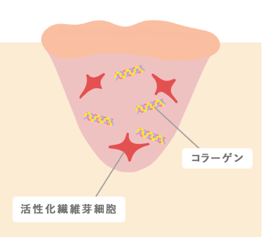 コラーゲンによる傷の治癒イメージ