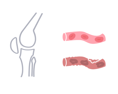 間接・骨、血管
