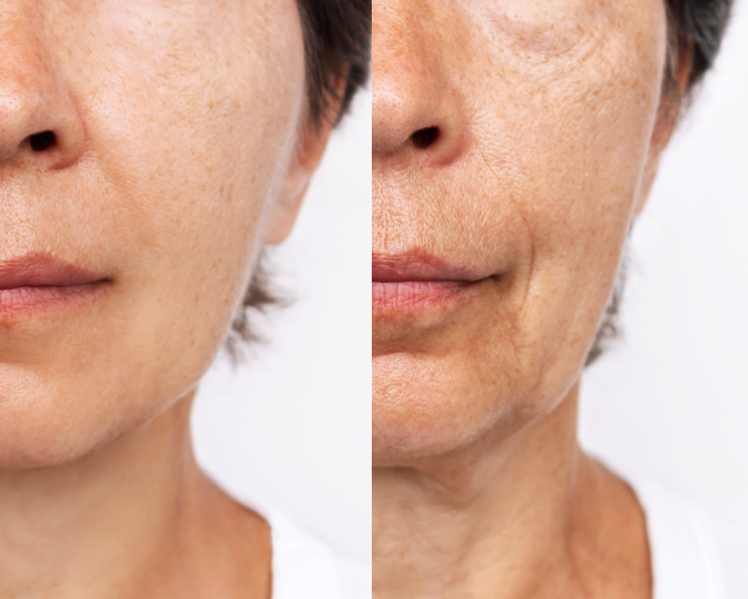 コラーゲンが不足すると イメージ