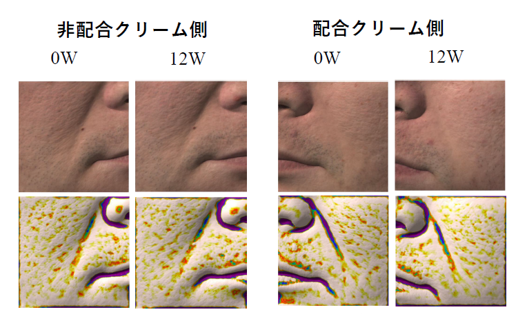 �畆3D�摜�i�A���e��3D�ɂ���z���E�z���̔�r�摜�j