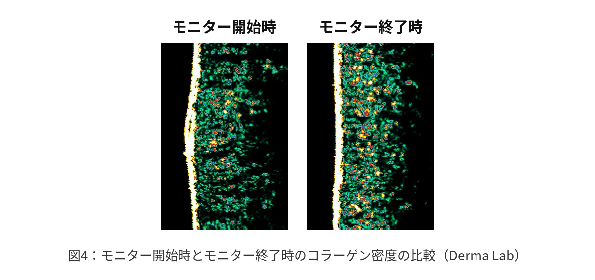 図4:モニター開始時とモニター終了時のコラーゲン密度の比較(Derma Lab)