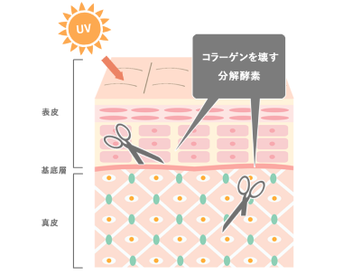 ���V���C���[�W