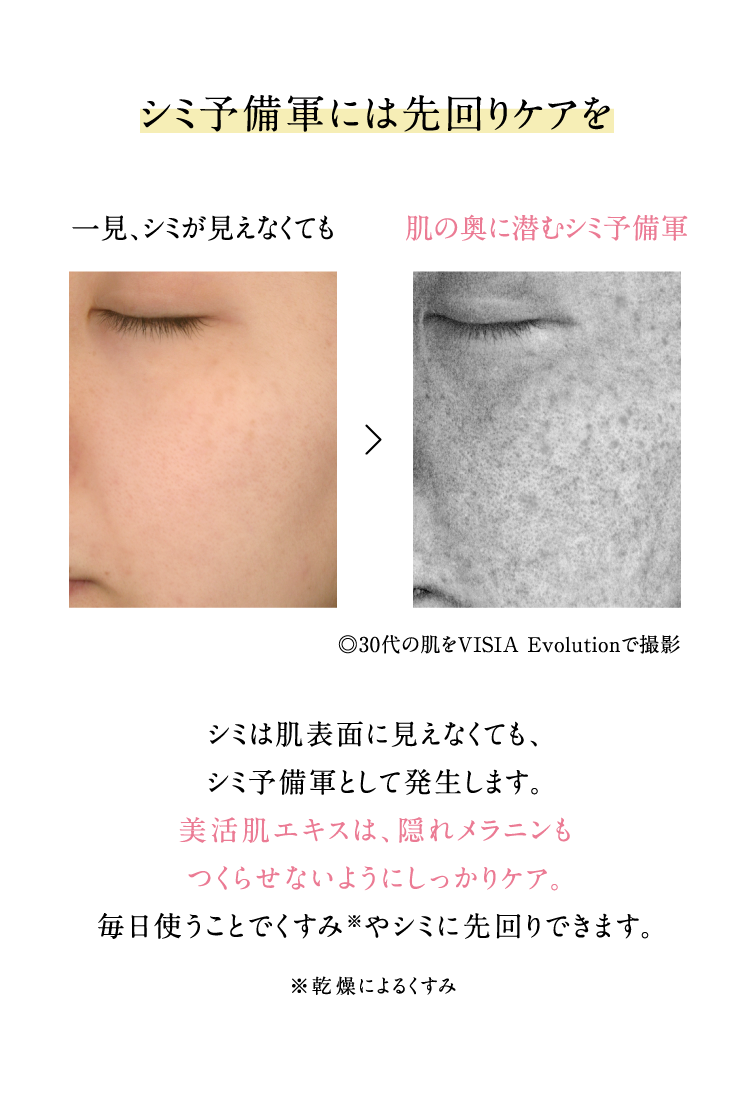 �V�~�\���R�ɂ͐���P�A��