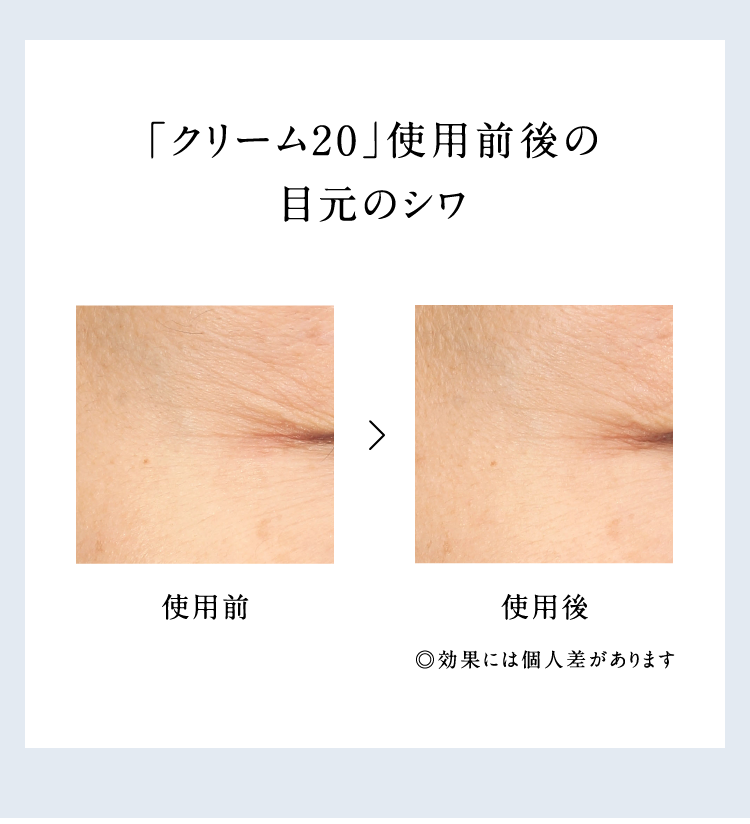 �u�N���[��20�v�g�p�O��̖ڌ��̃V��