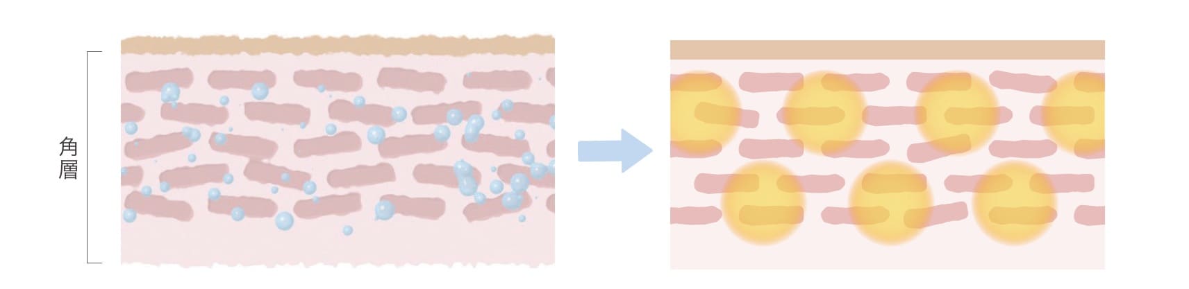 �A�N�e�B�u�R�A���u�[�g�Z�p�̃C���[�W�}