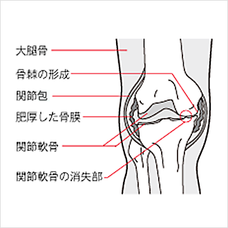 膝関節の図