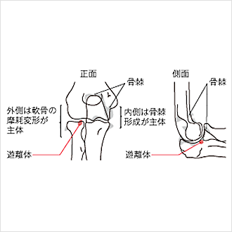 肘関節の図