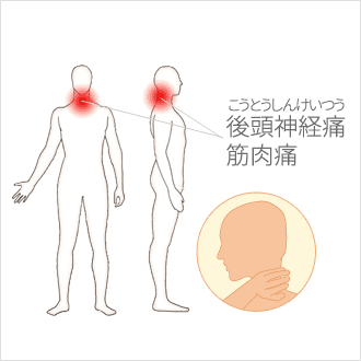 後頭部 が 痛い 左