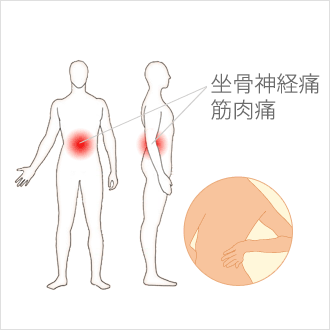 痛い 腰骨