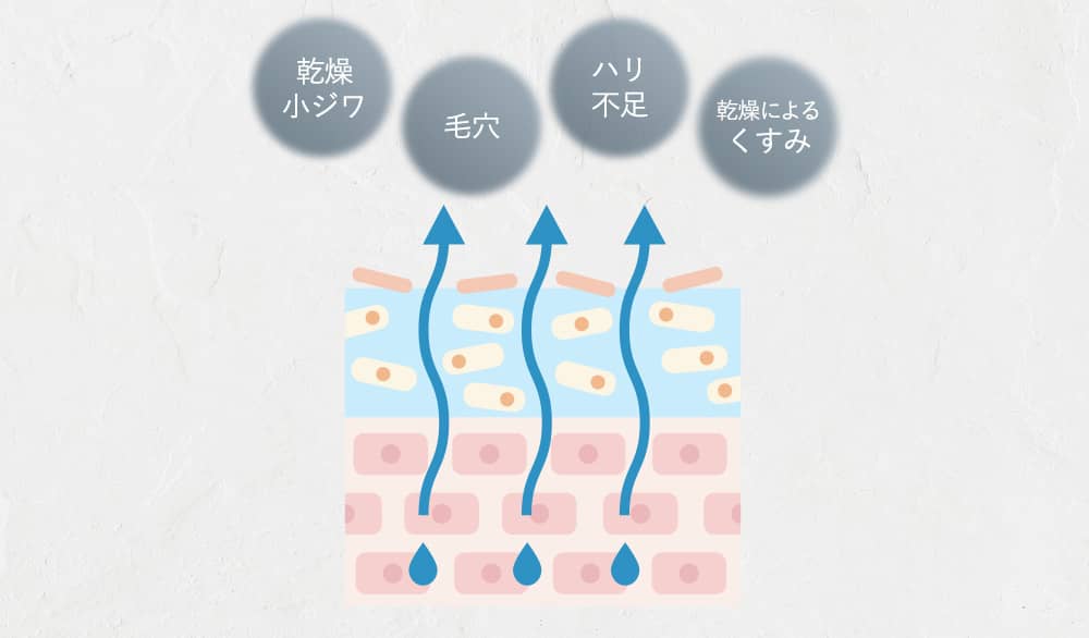 乾燥小ジワ 毛穴 ハリ不足 乾燥によるくすみ 肌図