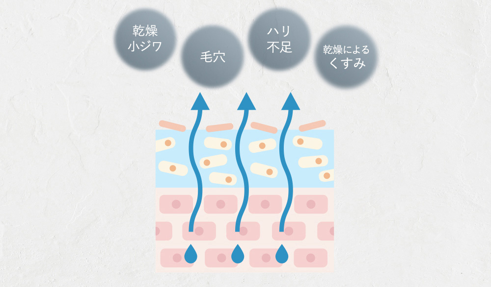 乾燥小ジワ 毛穴 ハリ不足 乾燥によるくすみ 肌図